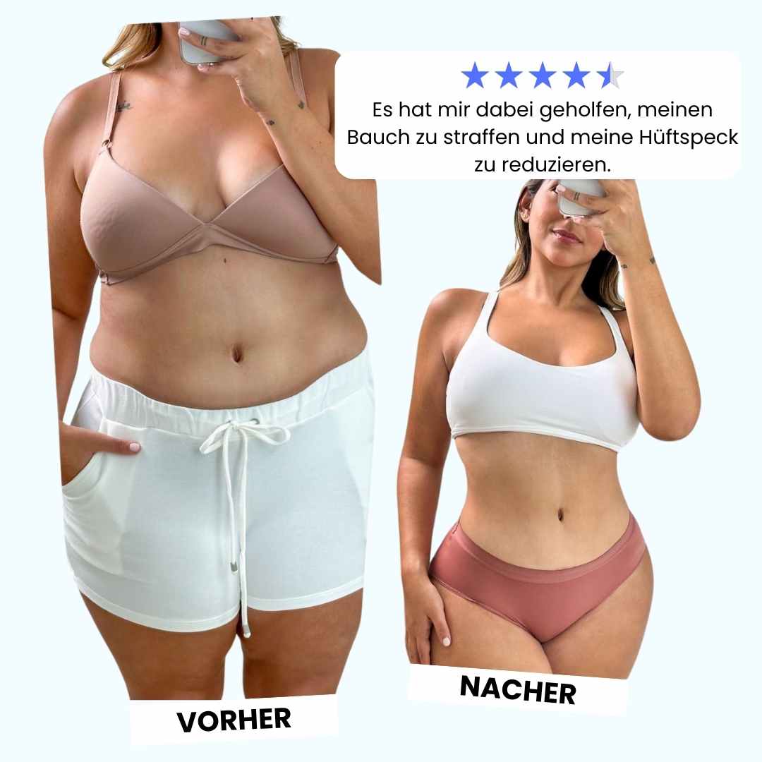 Cellugone 3.0 - Glatte & straffe Haut in nur 14 Tagen